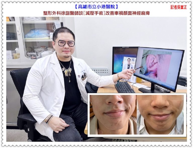 小港醫院整形外科徐詣醫師談減壓手術改善車禍顏面神經麻痺＠華夏新聞報