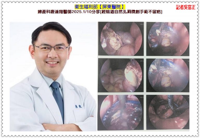 衛福部屏東醫院婦產科唐逢翔醫師2025.1/10分享[經陰道自然孔洞微創手術不留疤]＠華夏新聞報