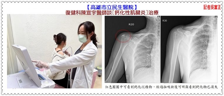 高雄市立民生醫院復健科陳宣宇醫師談[鈣化性肌腱炎]治療＠華夏新聞報